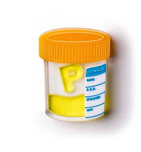 Specimen Jar - P Sample By Martini Slippers
